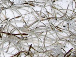 　不透明な漁獲や取引が指摘されているニホンウナギの稚魚、シラスウナギ（第１１管区海上保安本部提供）