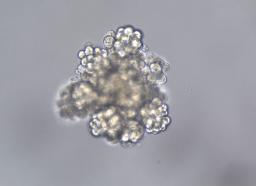 　成人の肝細胞を培養して１４日目のオルガノイド。大きさは約０・３ミリになった（佐藤俊朗慶応大教授提供）