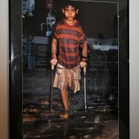 終戦後に残った地雷が原因で片脚を失った少年の写真。地雷の残骸で作った飛び石を歩いている

