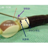 適切治療提供へ進歩　リンパ節に超音波活用　肺がんの診断（気管支鏡）　千葉県がんセンター呼吸器内科部長　新行内雅斗　【９月はがん征圧月間　ちば　がんにうち克つ】（１１）